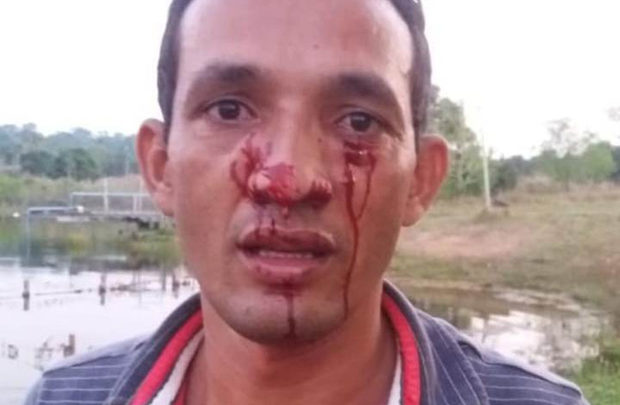 Homem é atacado no rosto por sucuri de três metros sucuriataque2 620x405 - Homem é atacado no rosto por sucuri de três metros
